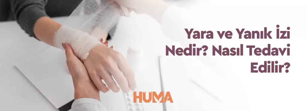 hüma hastanesi yara ve yanık izi