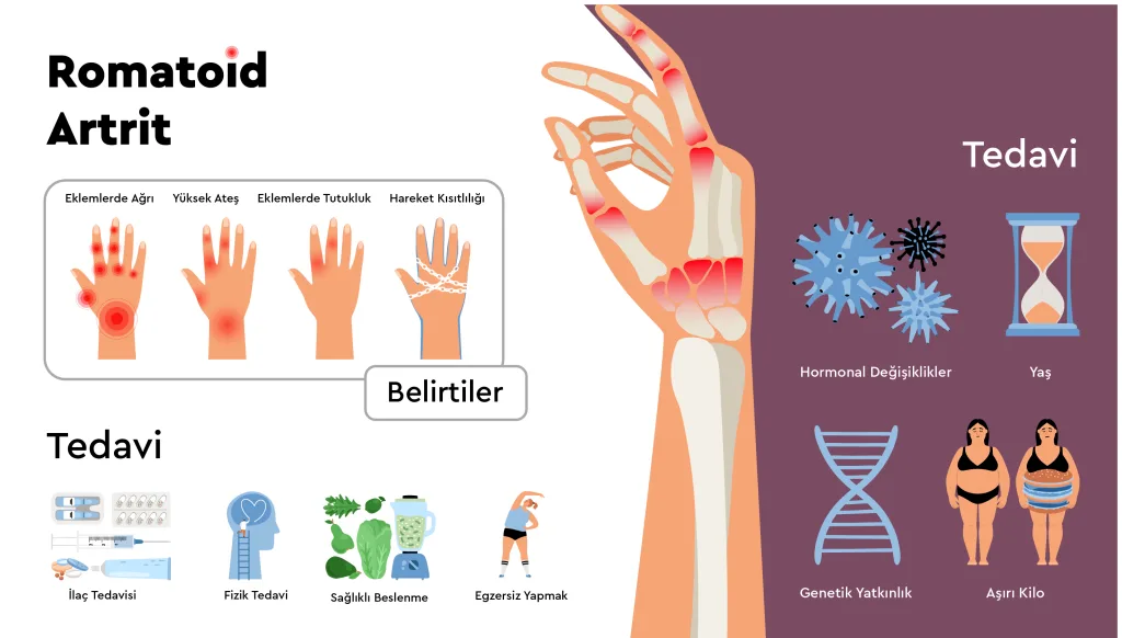 Romatoid Artrit (İltihaplı Romatizma) Nedir? Belirtileri, Teşhis ve Tedavisi 1 Romatoid Artrit info 01