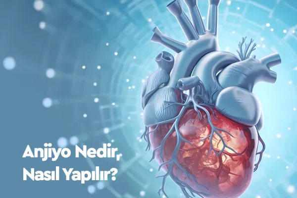 Anjiyo Nedir, Nasıl Yapılır?