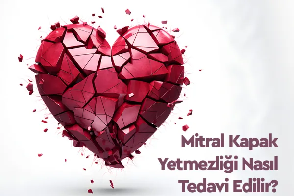 Mitral Kapak Yetmezliği Nedir, Belirtileri ve Tedavisi