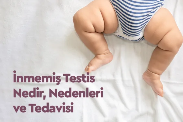 İnmemiş Testis Nedir, Nedenleri ve Tedavisi 