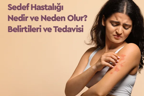 Sedef Hastalığı Nedir, Neden Olur? Belirtileri ve Tedavisi