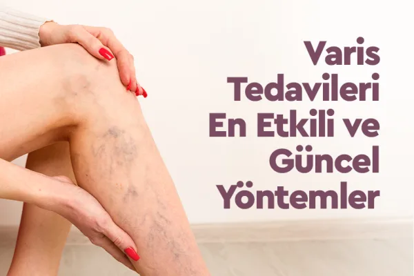 Varis Tedavileri En Etkili ve Güncel Yöntemler