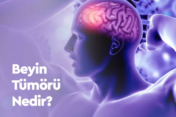 Beyin Tümörü Nedir? Beyin Tümörü Tedavi Yöntemleri Nelerdir?