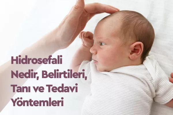 Hidrosefali Nedir, Belirtileri, Tanı ve Tedavi Yöntemleri