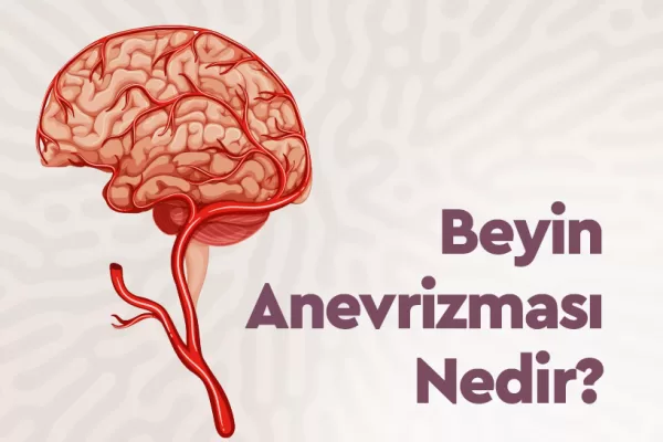 Beyin Anevrizması Nedir, Belirtileri ve Tedavi Yöntemleri 5 Beyin Anevrizması Nedir, Belirtileri ve Tedavi Yöntemleri
