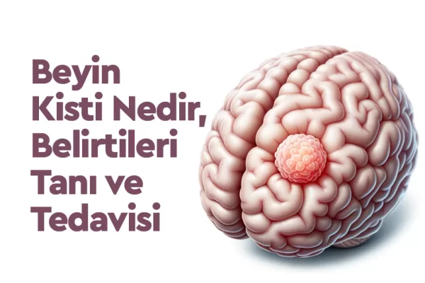 Beyin Kisti Nedir, Belirtileri Tanı ve Tedavisi 4 Beyin Kisti Nedir, Belirtileri Tanı ve Tedavisi