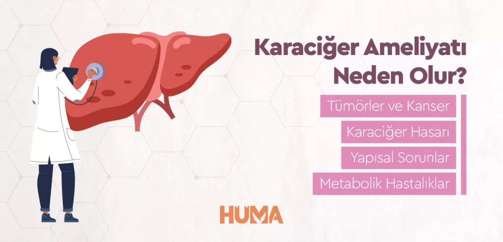 Karaciğer Ameliyatı Nedir? Karaciğer Ameliyatı Nasıl Yapılır? 1 Karaciger Ameliyati Neden Olur