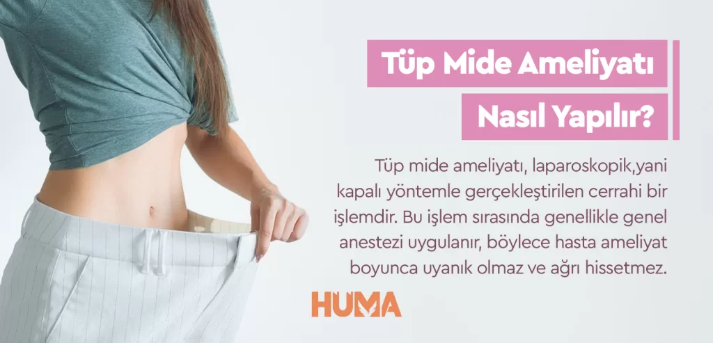 Tüp Mide Ameliyatı Nedir? Tüp Mide Ameliyatı Nasıl Yapılır? 1 ameliyat nasil yapilir