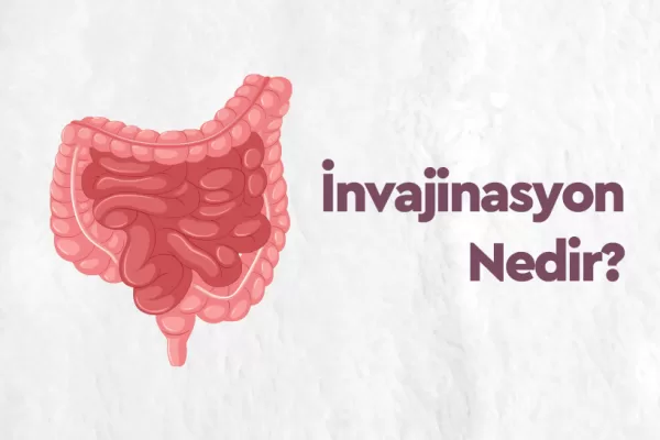 İnvajinasyon Nedir? Belirtileri, Tedavi Yöntemleri ve Ameliyat Süreci 1 İnvajinasyon Nedir? Belirtileri, Tedavi Yöntemleri ve Ameliyat Süreci