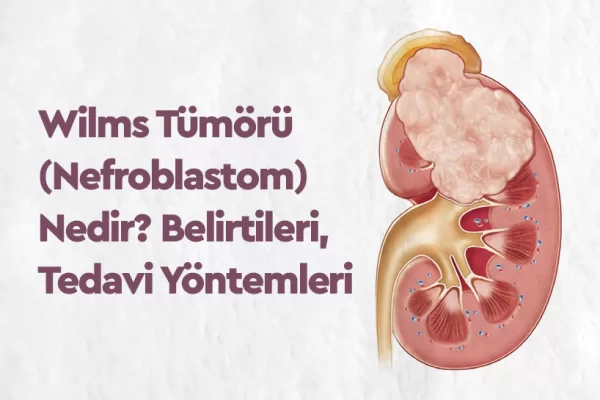 Wilms Tümörü (Nefroblastom) Nedir? Belirtileri, Tedavi Yöntemleri 2 Wilms Tümörü (Nefroblastom) Nedir? Belirtileri, Tedavi Yöntemleri