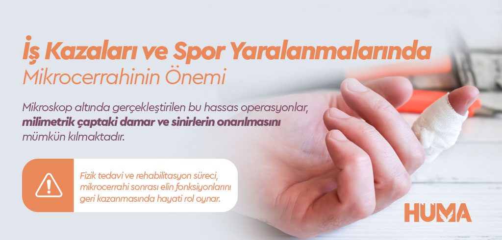 El Cerrahisi Nedir? Mikrocerrahi Yöntemleri ile Kalıcı Çözümler 2 el cerrahisi3