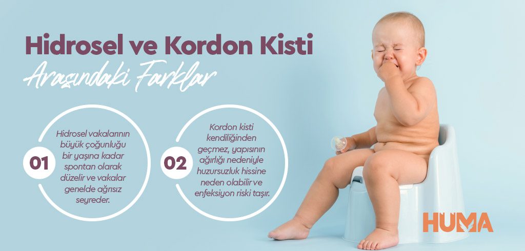 Hidrosel ve Kordon Kisti: Belirtiler, Tanı Yöntemleri ve Tedavi Süreci 2 hidrosel ve kordon kisti3