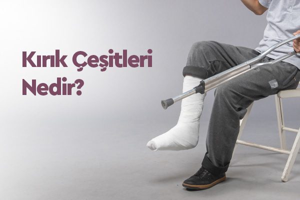Kırık Çeşitleri Nedir? Uzman Görüşleri ve Tedavi Yaklaşımları 1 Kırık Çeşitleri Nedir? Uzman Görüşleri ve Tedavi Yaklaşımları