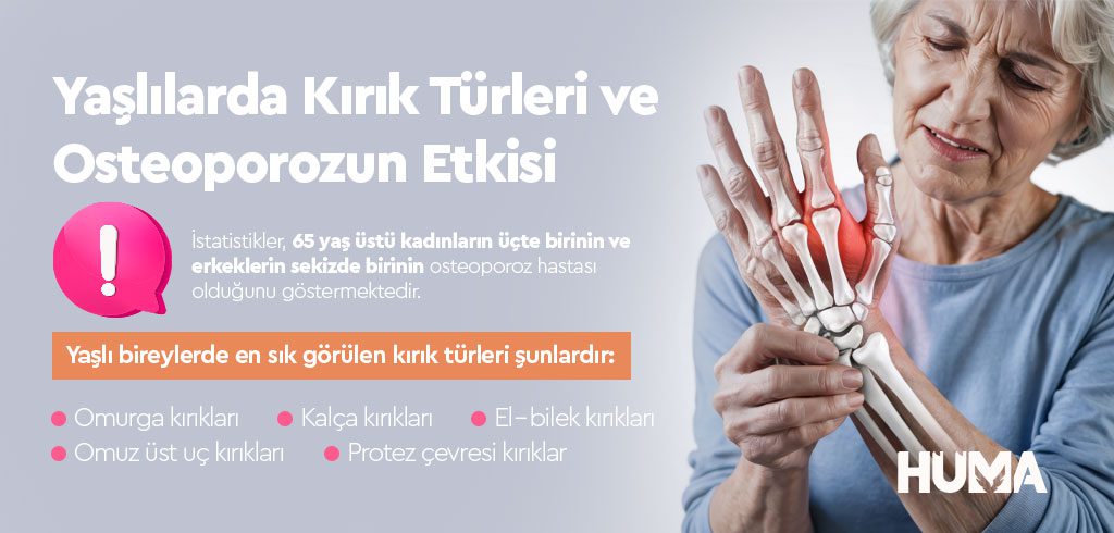 Kırık Çeşitleri Nedir? Uzman Görüşleri ve Tedavi Yaklaşımları 2 kirik turleri3