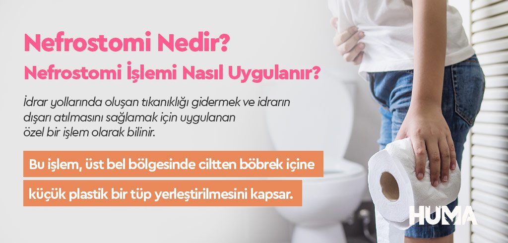 Nefrostomi Nedir? Nefrostomi İşlemi Nasıl Uygulanır?  1 nefrostomi2