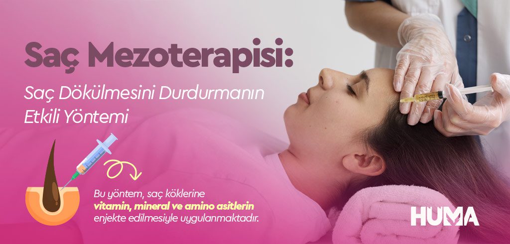Saç Mezoterapisi: Saç Dökülmesini Durdurmanın Etkili Yöntemi 1 sac mezoterapisi2