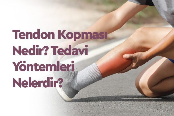 Tendon Kopması Nedir? Belirtileri, Nedenleri ve Tedavi Yöntemleri