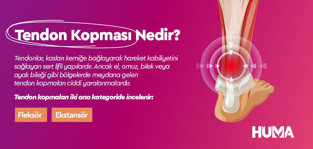 tendon kopmasi2 1