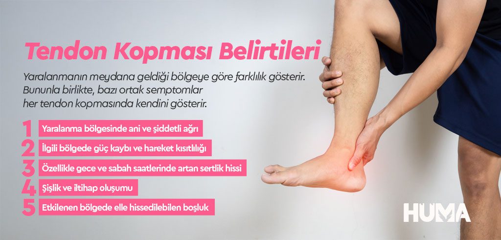 tendon kopmasi3