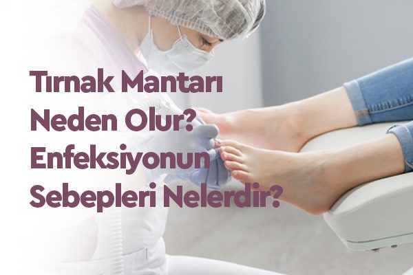 Tırnak Mantarı Nedir? Belirtileri, Nedenleri ve Tedavi Yöntemleri 1 Tırnak Mantarı Nedir? Belirtileri, Nedenleri ve Tedavi Yöntemleri